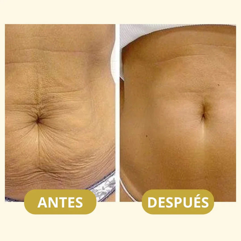 Aceite Original Corporal Magic™